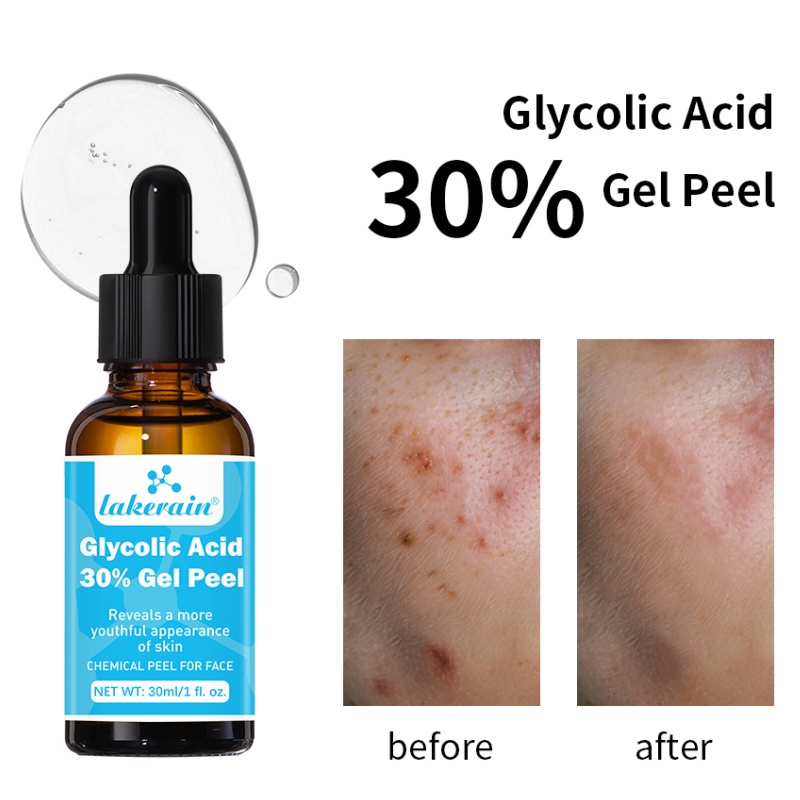 Lactic Acid Toner - Gel exfoliante de ácido glicólico 30%,